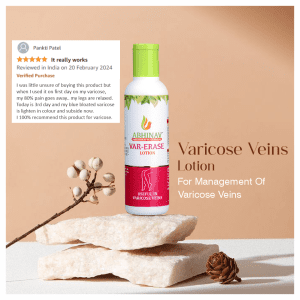 Ayurvedic medicine for varicose veins Var-Erase lotion